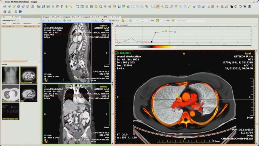 Evorad RIS-PACS workstation showing diagnostic medical images and visualization tools