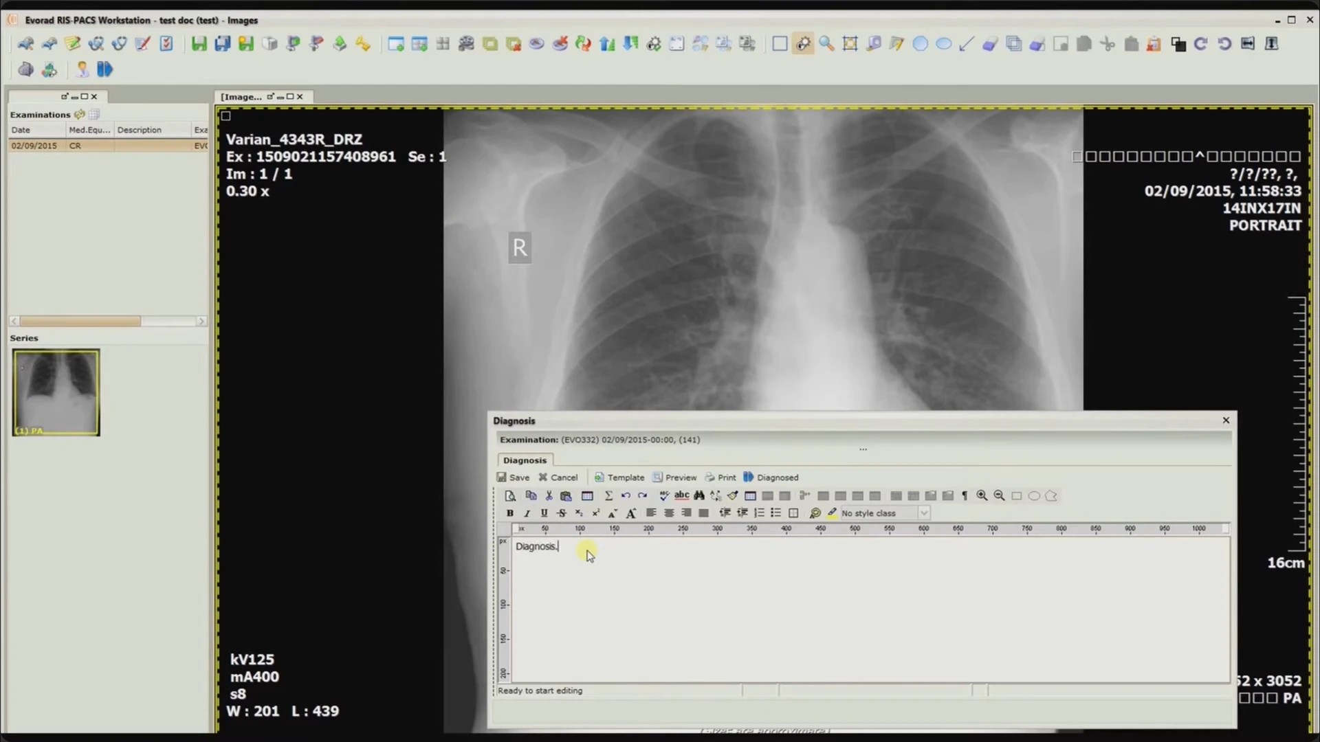 The diagnosis editor open over a chest radiograph, with formatting controls and template, preview, print, and diagnosed options.