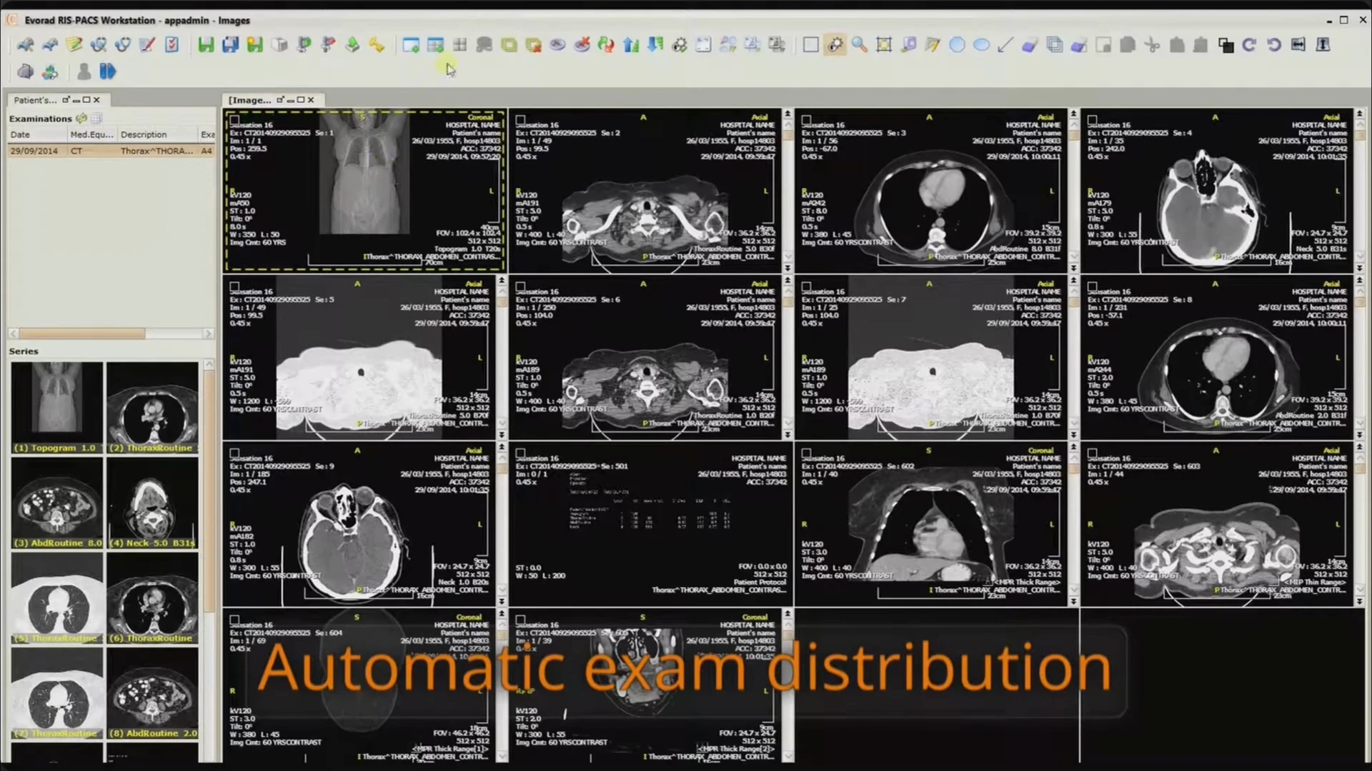 A multi-cell image grid displaying numerous CT series alongside the examination and series browser.
