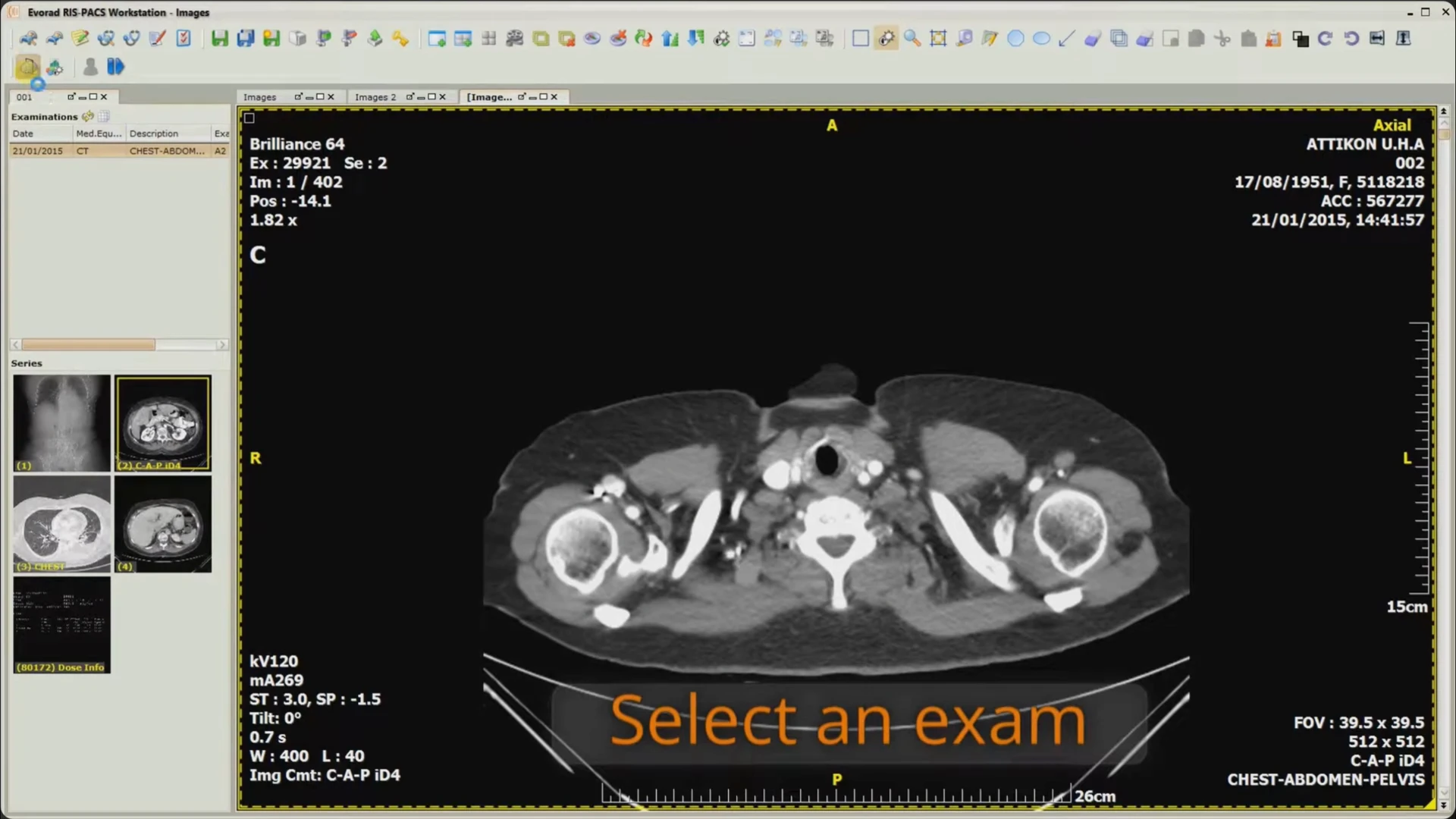 The Evorad image viewer showing a CT slice, examination list, series thumbnails, and imaging toolbar.